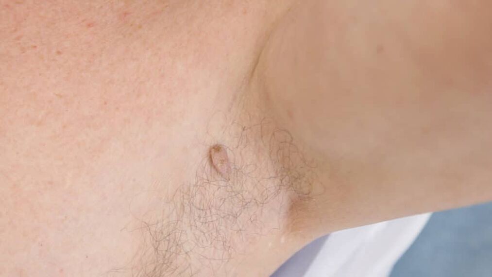 Papilloma de filme