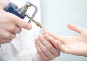 métodos modernos de remoção de papilomas