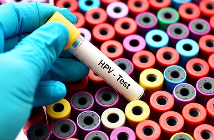 Exame de sangue do papilomavírus humano