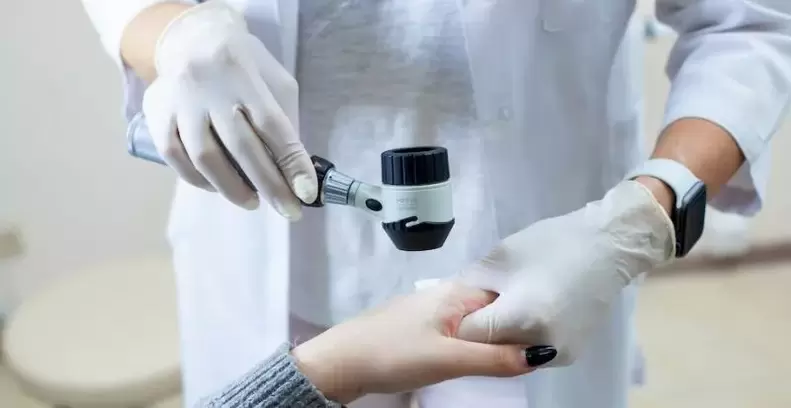 Paciente com verrugas submetido a exame diagnóstico por dermatologista